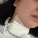 성빈센트병원(병동약국 앞) | 30대 캥거루의 갑상선암 기록,,, 입원~수술 히슷톨이,, part3