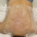 씨유천안백석현대점 | [천안 백석] 등드름 관리 이정희스킨케어(+해초필링 후기)