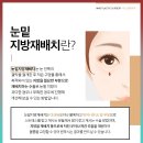 더이노써클