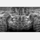 엠플란트치과의원 이미지