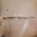 르슈가래쉬 | [성정동 더마플래닝] 르슈가 더마플래닝