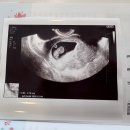 [임신일기2] 8-9주차, 초기 임산부 전주여행, 여전한 탄산 입덧, 첫찌의 두돌사진, 경산모는 쉴수없어...