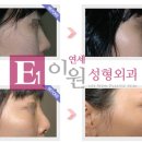 연세이원성형외과의원 이미지