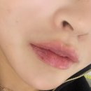 수원-1509 | 해운대 ’미엘르‘ 립퍼밍 받은 솔직후기