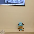 서구-37 | 광주 서구 치과 어금니 골드 인레이 치료 후기