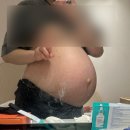 효성과일 | 효성병원 경산모 제왕절개 후기와 입원라이프 (둘째 별거 없네 …😏)