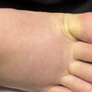 함춘산부인과 전원 후기 (서울삼성병원 산부인과 출산준비물, 도곡함춘산부인과 출산준비물, 서울삼성...