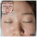 귤현역 앞 | 검단 아라동 피부관리 기미, 주근깨 관리는 미작뷰티 검단에서~🥰🫢