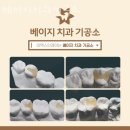 베이지치과기공소 이미지