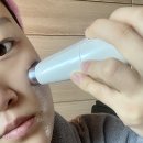 영메디텍 | 리프팅 효과 대박인 뷰티디바이스 듀얼소닉