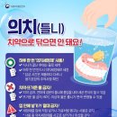 의치 치약으로 닦으면 안돼요 이미지