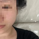 강남셀럽의원 | [서울 청담동] 청담동 피부과 셀럽관리 받고온 후기(울페이셜, 리프팅)