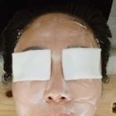 미고 테라피 이미지