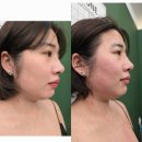 [뷰티리뷰] 평창군 얼굴 관리는 뷰티다미안에서 / 피부관리 멀티샵/ 진부네일 / 진부마사지/ 진부체형관리
