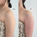 다온온열카페 | 옥정웨딩관리 스파다온 | 바디관리하러 재방문 | 팔살슬리밍+ 팔 코르셋!! 여름관리강추!!