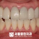 열린미소치과의원 이미지