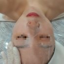 경산진량피부관리, 진량에스테틱 [이새뷰티 주름마법사]