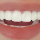 팀플란트치과의원 이미지