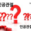 퇴행성관절염 무릎인공관절수술, 무릎인공관절후재활 이미지