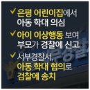 한 은평구 어린이집서 3살 아이 아동학대 의심 이미지