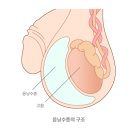 16. 육아일기_요도하열 첫 검진 (백민기 아이사랑비뇨의학과)