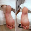 레푸스 화정점 | 고양각질제거 잘하는 곳 레푸스 화정점 후기