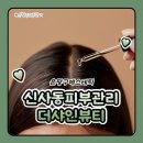 은평구피부관리 신사동피부관리 더샤인뷰티 건식두피관리 후기