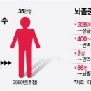 "의사 1명이 환자 500명 책임"…'골치 아픈' 뇌졸중 진료체계 이미지