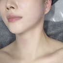 에이원 | 황금동 윤곽관리 에이원뷰티 대구본점 후기