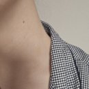 김형진베이직성형외과의원 | [보톡스] 넥슬림주사 2차 후기 (1차 3개월차, 2차 1주차 비교)