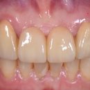 세온 치과기공소 이미지