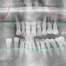 미켈란치과의원 이미지