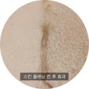 미엘피부관리