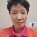 강외과의원 | 그날성형외과 후기, 내시경이마거상술이란