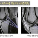 동탄고교 네이버블로그