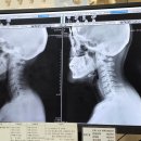 연세마취통증의학과의원 | 부천 역곡역 연세안마취통증의학과 방문 후기,어깨 통증 치료 후기