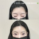 보강네츄럴 이미지