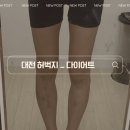 동아에스티(주)대전지점 | 대전 지방분해주사 일자다리 만들기 후기