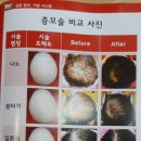 백광수선