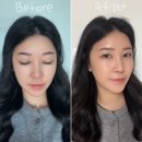 레드스퀘어 | 홍조크림 추천 더마스퀘어 레드스킵 찐사용 후기