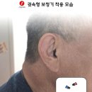 시그니아독일보청기 이미지