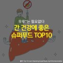 슈퍼Top