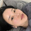 회춘한의원 | 40대 이중턱 관리 부산 서면역 근처 온다리프팅 2회차 후기