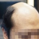 킹헤어(남성컷트전문점)