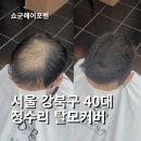 강북구 서울 정수리탈모커버로 자신감 되찾으세요