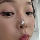 로제피부과의원 네이버블로그