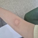 용신71 | 서울 항원항체검사 병원(+공무원채용신체검사) : 위치/가격