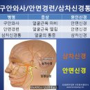 구안와사 ? 안면경련? 같은듯 달라 광주 김성훈한의원 이미지