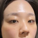 바로그의원경주 아쿠아필, 카프리, 피코토닝 리얼 후기
