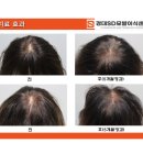 헤어젠 이미지